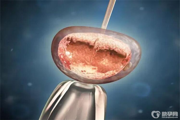 广州三代供卵试管婴儿(广州三代供卵试管婴儿：新生命的奇迹)