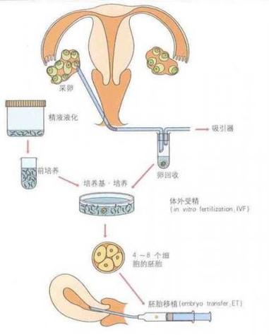 试管代怀妈妈在哪里找_试管代怀妈妈在哪里找?寻找试管代怀妈妈的途径