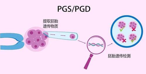 试管代怀怎么做的【试管代怀怎么做?全面解析试管代怀孕的流程及注意事项】