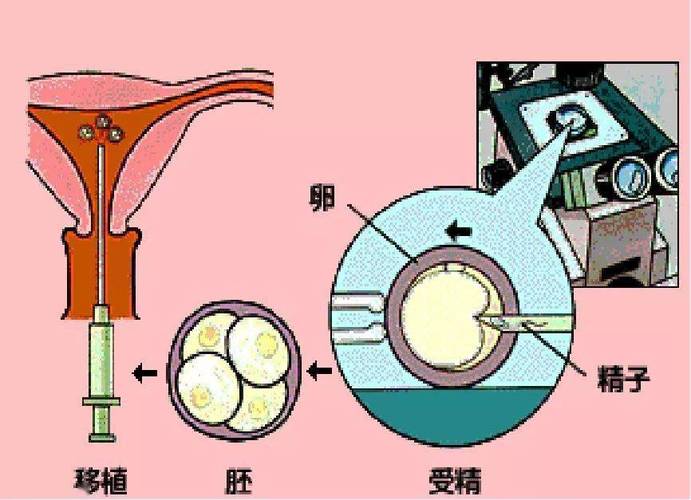 试管代怀怎么方法_试管代怀孕的操作步骤和注意事项